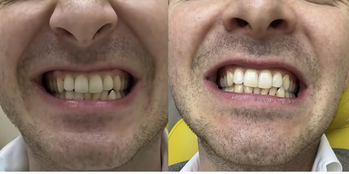 Customer review image