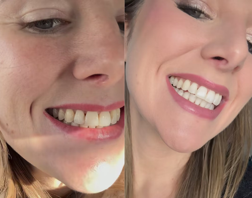 Customer review image