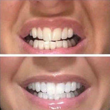 Customer review image